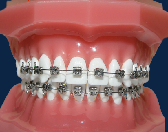 Orthodontics